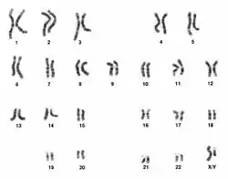 Caryotype d'un homme ; les 22 premières paires de chromosomes sont appelées autosomes.